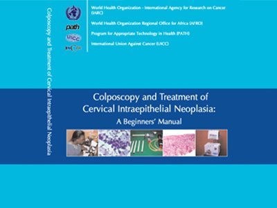 WHO - Colposcopy and Treatment of Cervical Intraepithelial Neoplasia: A Beginners’ Manual - (2004) PDF 1