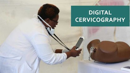 Digital Cervigocraphy or a nonphysician taking photo of a patients cervix as part of cervical cancer screening via Cerviq app and help end cervical cancer in the Philippines